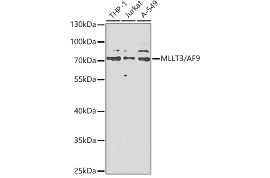 Western Blot - Anti-AF9 Antibody (A12020) - Antibodies.com