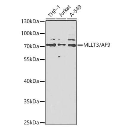 Western Blot - Anti-AF9 Antibody (A12020) - Antibodies.com