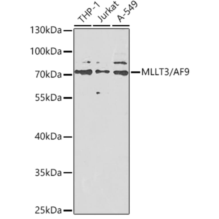 Western Blot - Anti-AF9 Antibody (A12020) - Antibodies.com