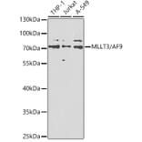 Western Blot - Anti-AF9 Antibody (A12020) - Antibodies.com