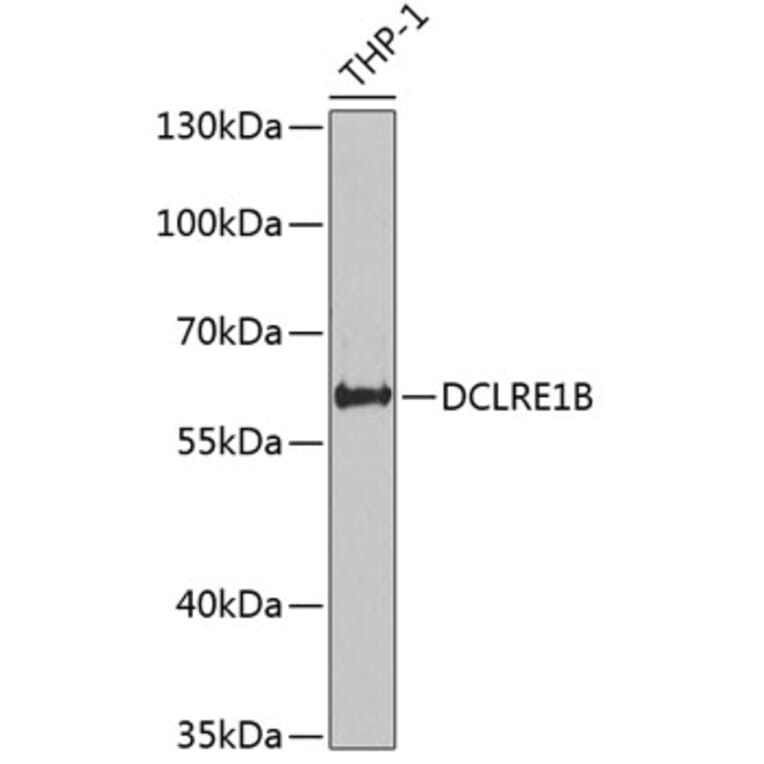 Western Blot - Anti-DCLRE1B Antibody (A12021) - Antibodies.com
