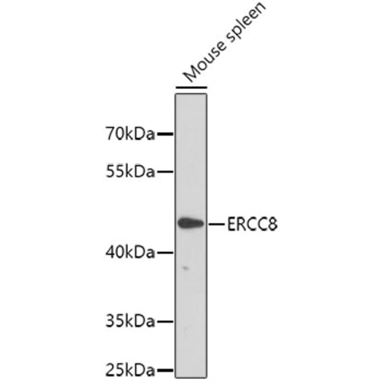 Western Blot - Anti-ERCC8 Antibody (A6809) - Antibodies.com