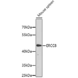 Western Blot - Anti-ERCC8 Antibody (A6809) - Antibodies.com