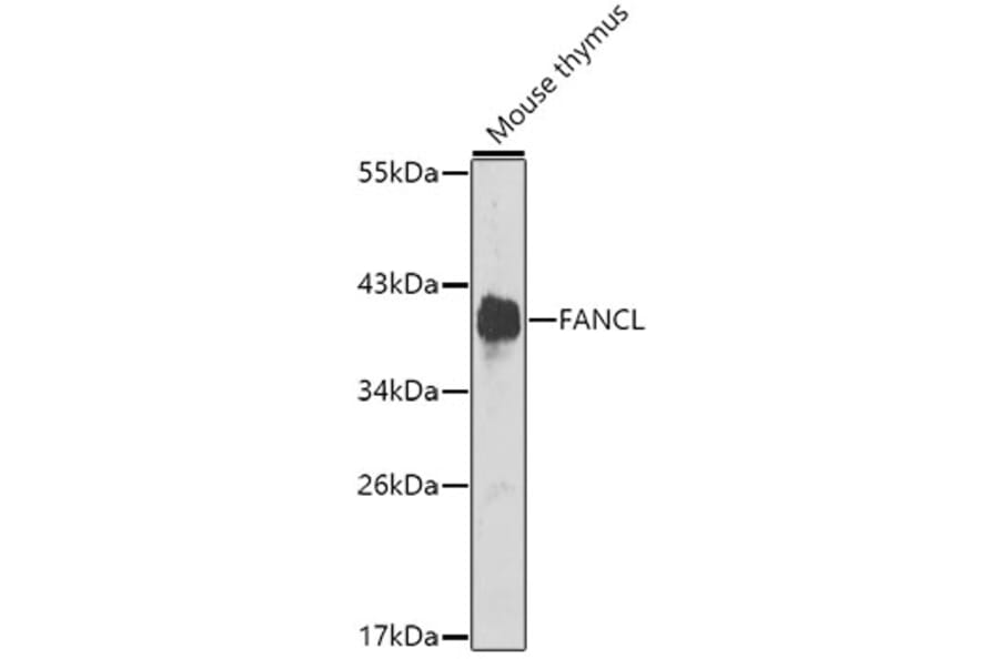 Western Blot - Anti-FANCL Antibody (A12023) - Antibodies.com
