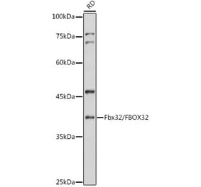 Western Blot - Anti-Fbx32 Antibody (A12024) - Antibodies.com