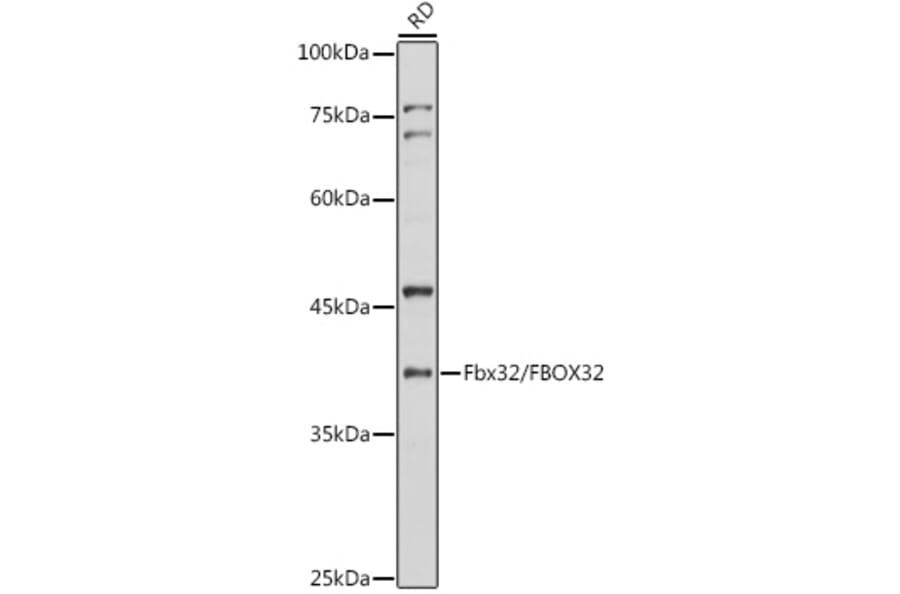 Western Blot - Anti-Fbx32 Antibody (A12024) - Antibodies.com