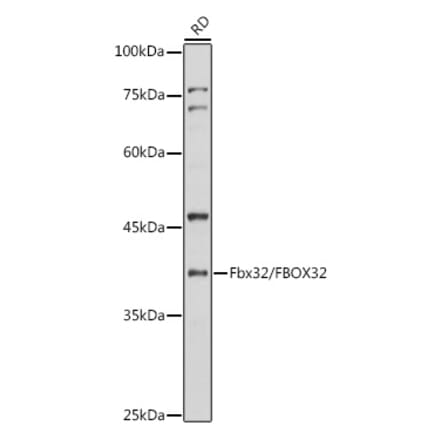 Western Blot - Anti-Fbx32 Antibody (A12024) - Antibodies.com
