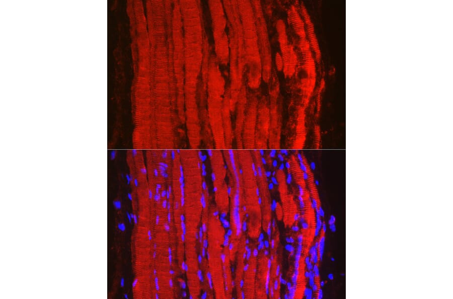 Immunofluorescence - Anti-Fbx32 Antibody (A12024) - Antibodies.com