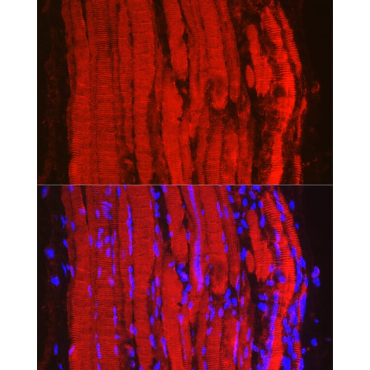 Immunofluorescence - Anti-Fbx32 Antibody (A12024) - Antibodies.com