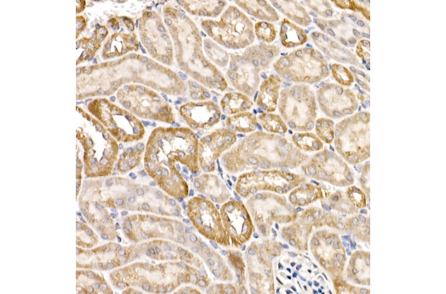 Immunohistochemistry - Anti-FACL4 Antibody (A12025) - Antibodies.com