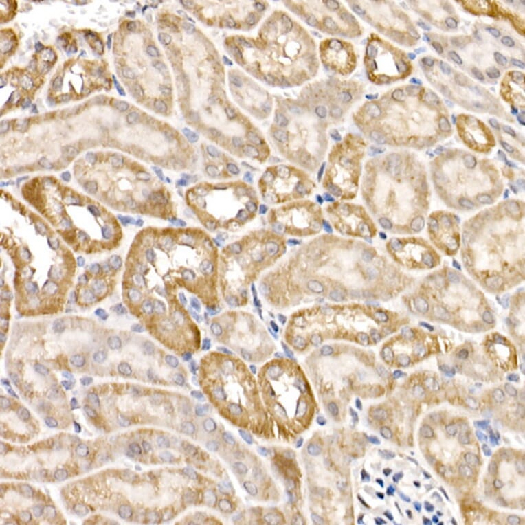 Immunohistochemistry - Anti-FACL4 Antibody (A12025) - Antibodies.com