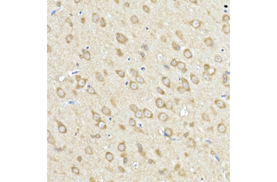 Immunohistochemistry - Anti-FACL4 Antibody (A12025) - Antibodies.com