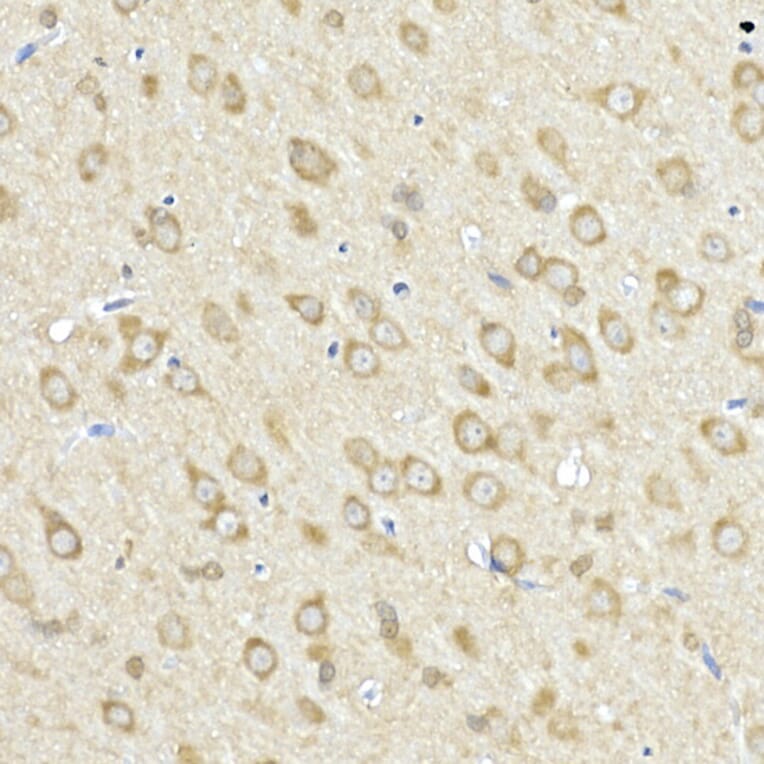 Immunohistochemistry - Anti-FACL4 Antibody (A12025) - Antibodies.com