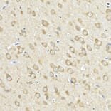 Immunohistochemistry - Anti-FACL4 Antibody (A12025) - Antibodies.com