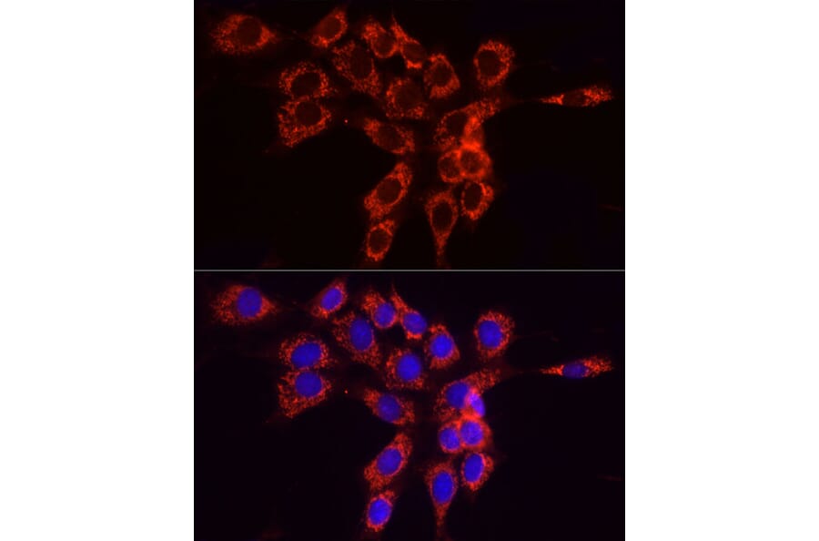 Immunofluorescence - Anti-FACL4 Antibody (A12025) - Antibodies.com