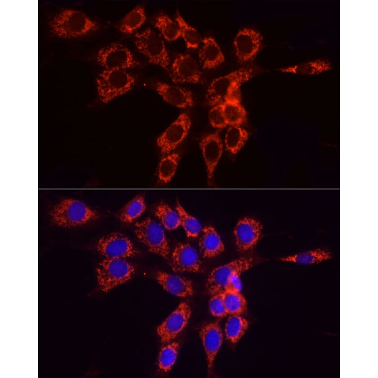 Immunofluorescence - Anti-FACL4 Antibody (A12025) - Antibodies.com