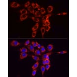 Immunofluorescence - Anti-FACL4 Antibody (A12025) - Antibodies.com