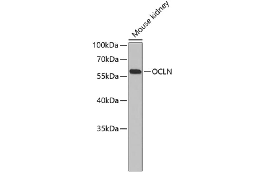 Western Blot - Anti-OCLN Antibody (A6827) - Antibodies.com