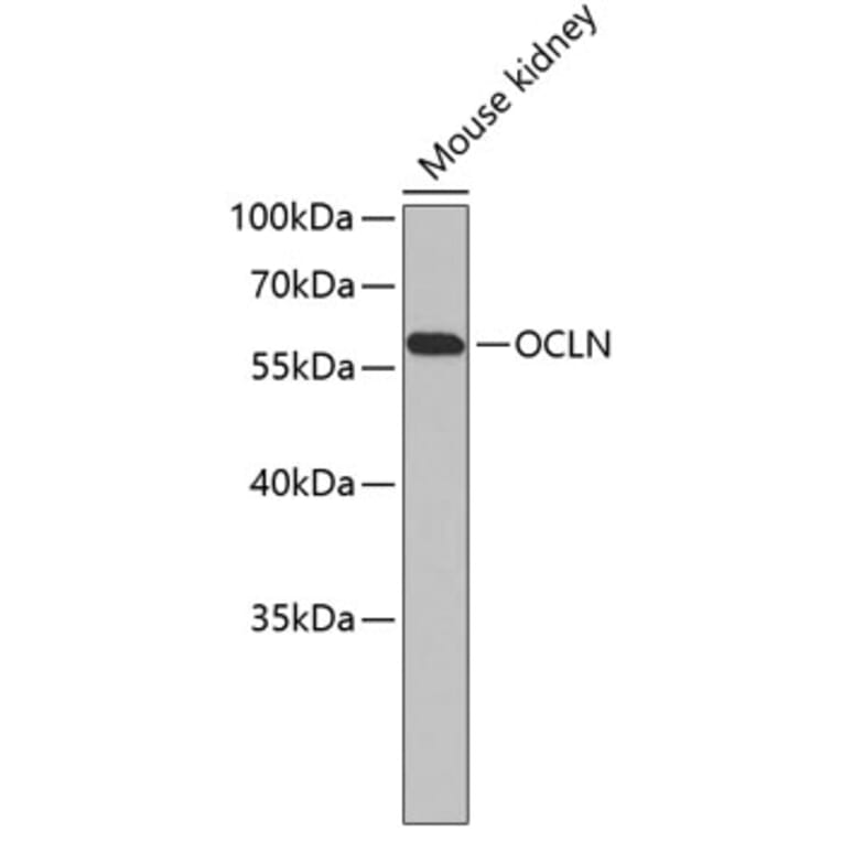 Western Blot - Anti-OCLN Antibody (A6827) - Antibodies.com