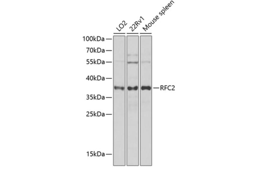 Western Blot - Anti-RFC2 Antibody (A12027) - Antibodies.com