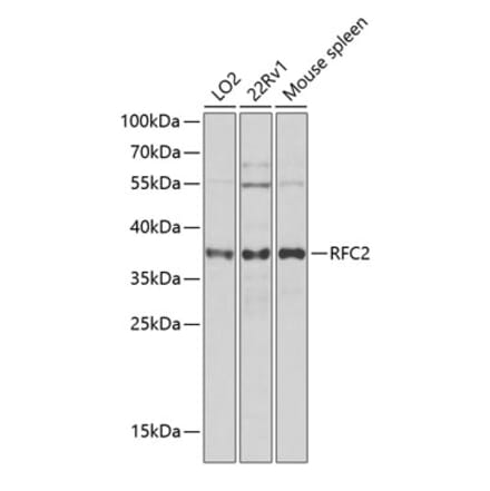 Western Blot - Anti-RFC2 Antibody (A12027) - Antibodies.com