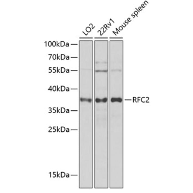 Western Blot - Anti-RFC2 Antibody (A12027) - Antibodies.com