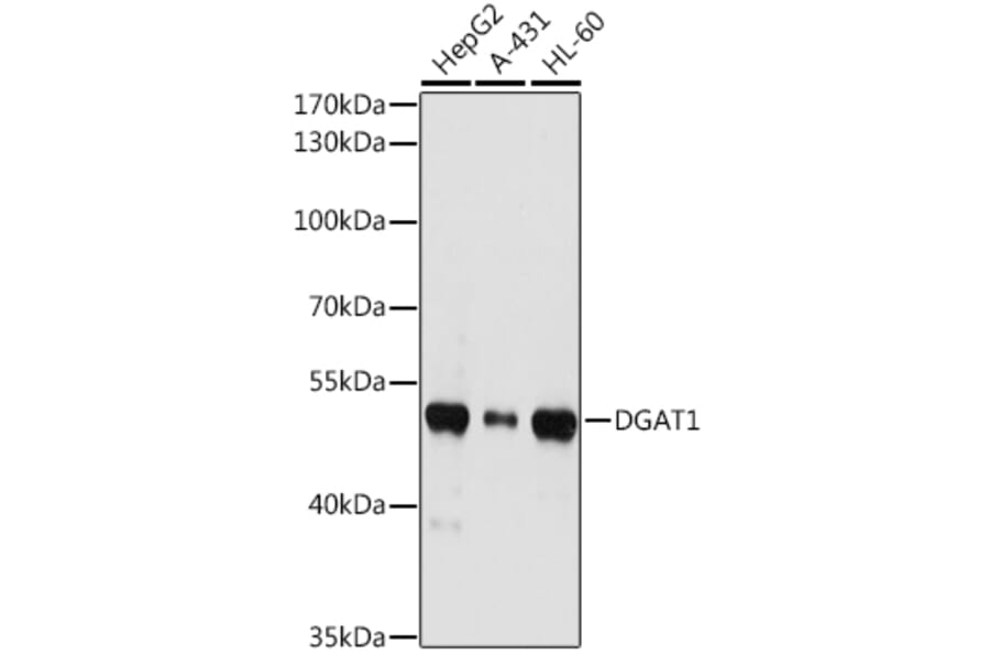 Western Blot - Anti-DGAT1 Antibody (A12028) - Antibodies.com