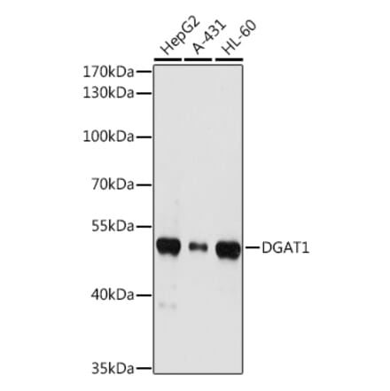 Western Blot - Anti-DGAT1 Antibody (A12028) - Antibodies.com