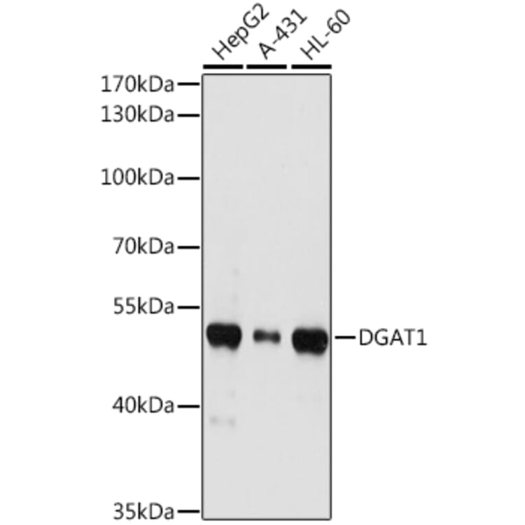 Western Blot - Anti-DGAT1 Antibody (A12028) - Antibodies.com