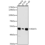 Western Blot - Anti-DGAT1 Antibody (A12028) - Antibodies.com