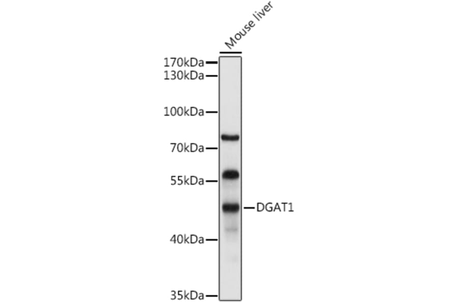 Western Blot - Anti-DGAT1 Antibody (A12028) - Antibodies.com