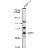 Western Blot - Anti-DGAT1 Antibody (A12028) - Antibodies.com