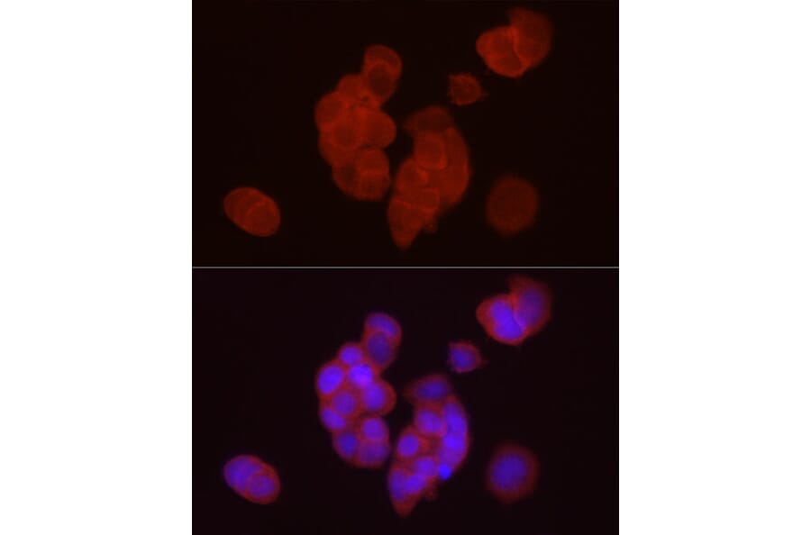 Immunofluorescence - Anti-DGAT1 Antibody (A12028) - Antibodies.com
