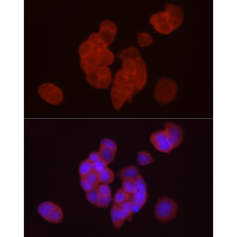 Immunofluorescence - Anti-DGAT1 Antibody (A12028) - Antibodies.com
