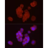 Immunofluorescence - Anti-DGAT1 Antibody (A12028) - Antibodies.com