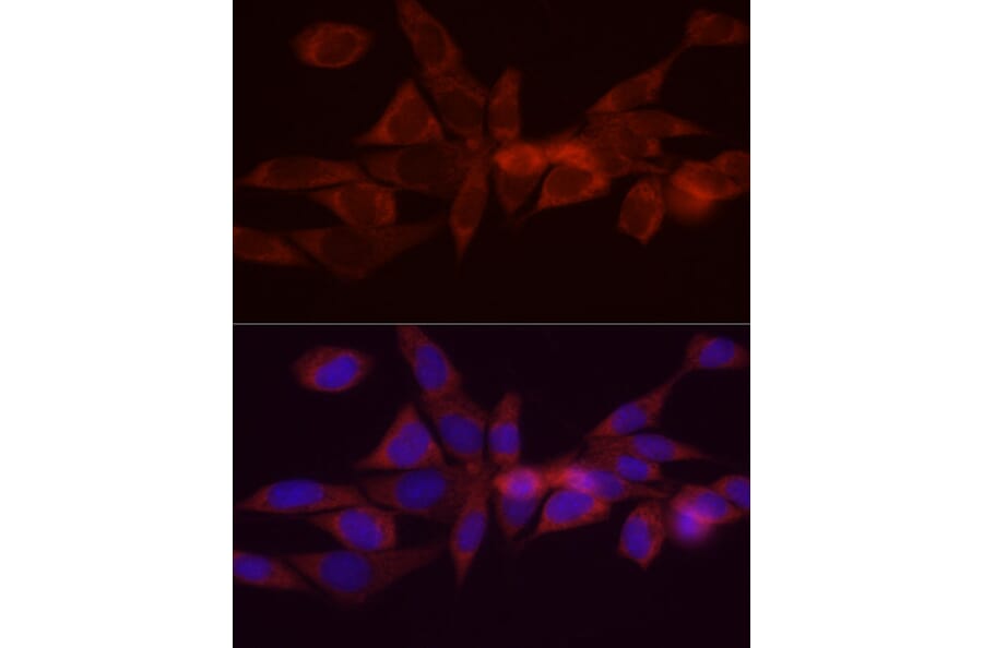Immunofluorescence - Anti-DGAT1 Antibody (A12028) - Antibodies.com