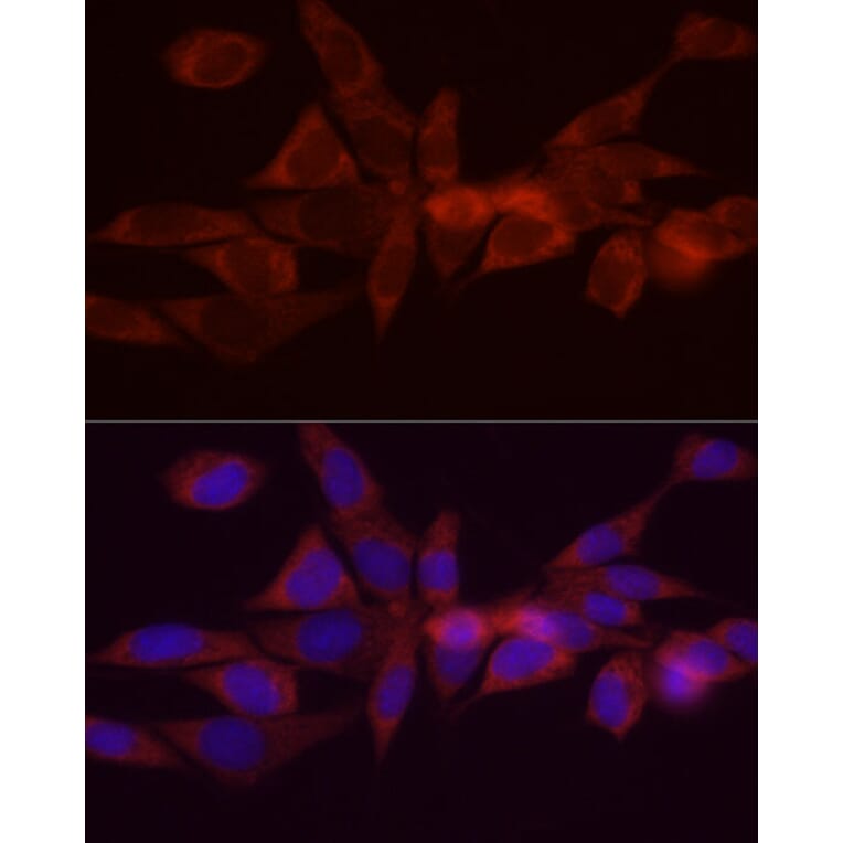 Immunofluorescence - Anti-DGAT1 Antibody (A12028) - Antibodies.com