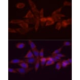 Immunofluorescence - Anti-DGAT1 Antibody (A12028) - Antibodies.com