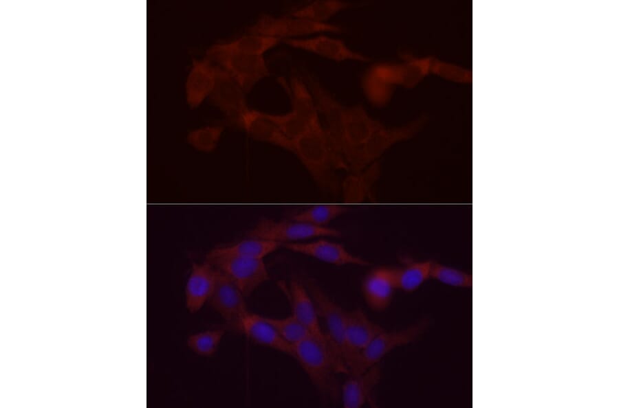 Immunofluorescence - Anti-DGAT1 Antibody (A12028) - Antibodies.com