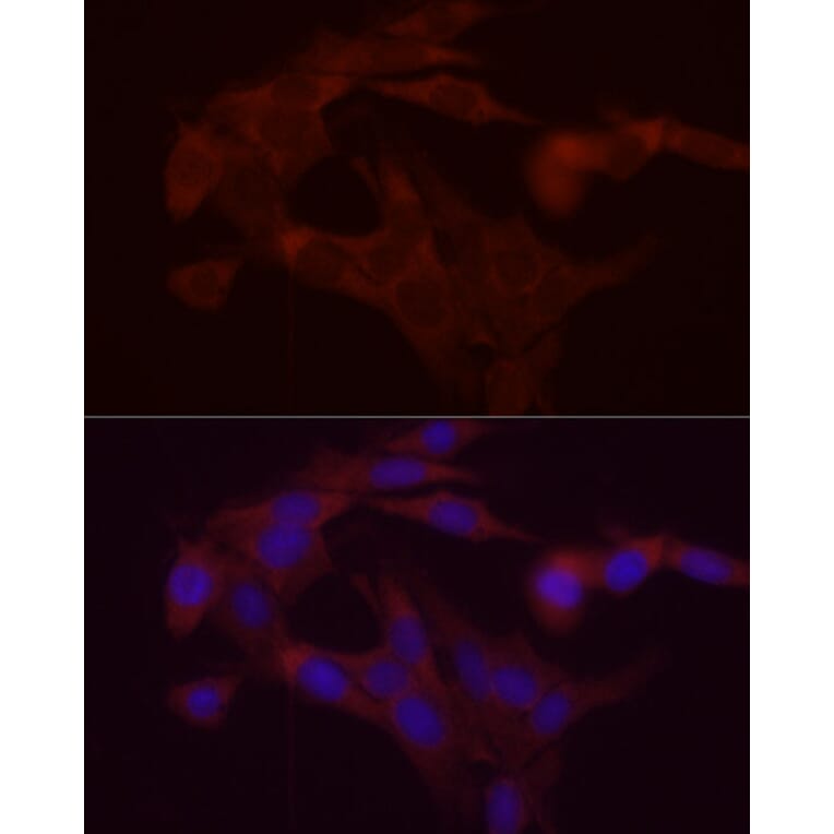 Immunofluorescence - Anti-DGAT1 Antibody (A12028) - Antibodies.com