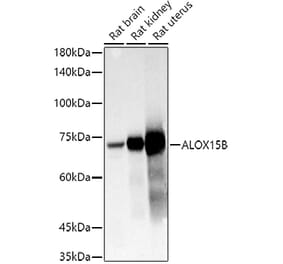 Western Blot - Anti-15-LOX-2 Antibody (A12029) - Antibodies.com