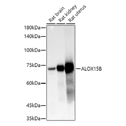 Western Blot - Anti-15-LOX-2 Antibody (A12029) - Antibodies.com