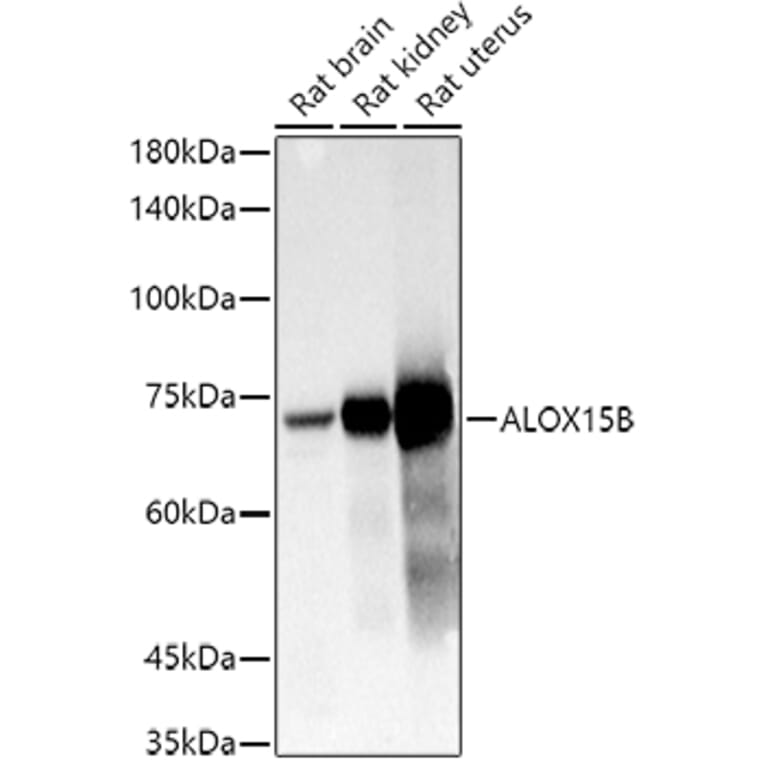Western Blot - Anti-15-LOX-2 Antibody (A12029) - Antibodies.com