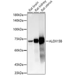 Western Blot - Anti-15-LOX-2 Antibody (A12029) - Antibodies.com