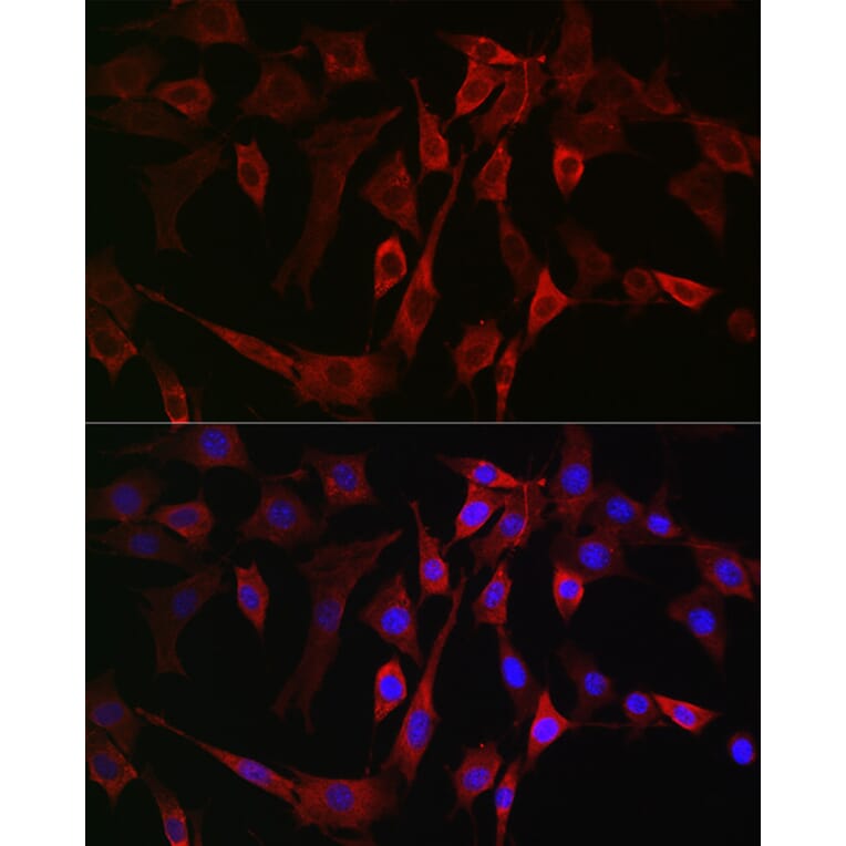 Immunofluorescence - Anti-15-LOX-2 Antibody (A12029) - Antibodies.com