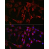Immunofluorescence - Anti-15-LOX-2 Antibody (A12029) - Antibodies.com