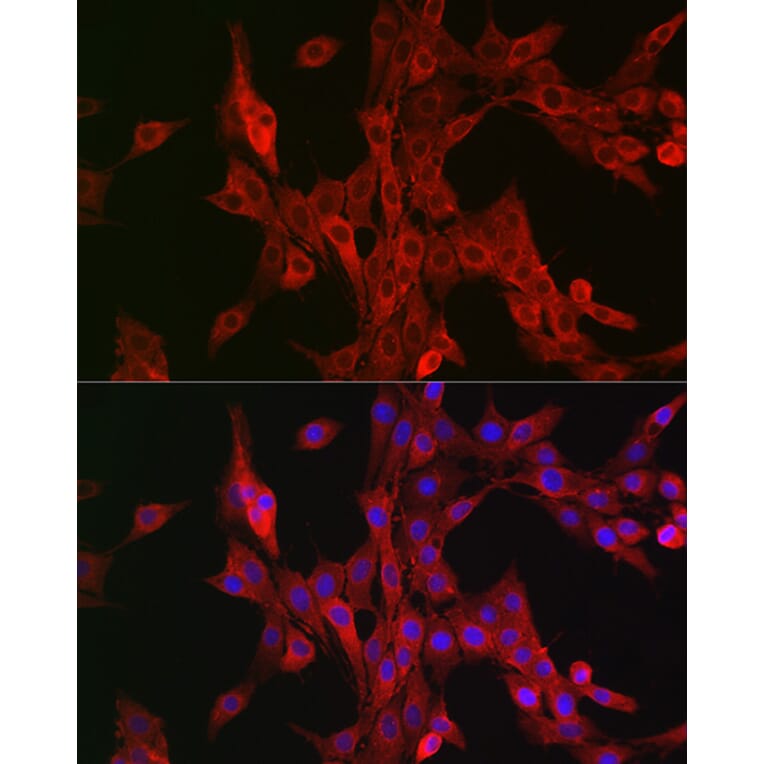 Immunofluorescence - Anti-15-LOX-2 Antibody (A12029) - Antibodies.com