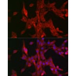 Immunofluorescence - Anti-15-LOX-2 Antibody (A12029) - Antibodies.com