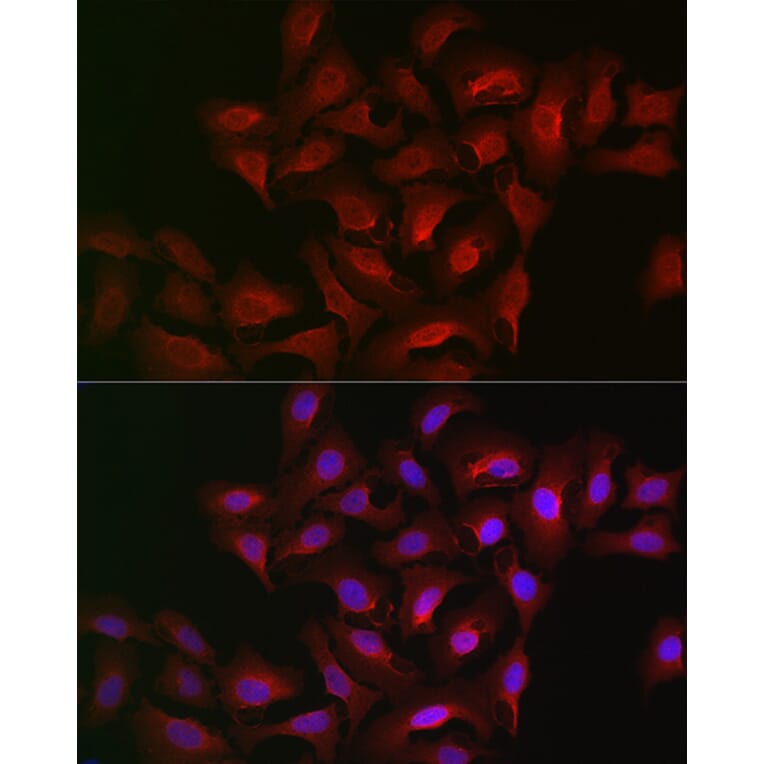 Immunofluorescence - Anti-15-LOX-2 Antibody (A12029) - Antibodies.com