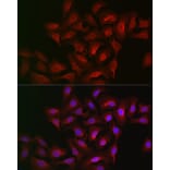 Immunofluorescence - Anti-15-LOX-2 Antibody (A12029) - Antibodies.com